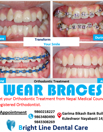 Bright Line Dental Care